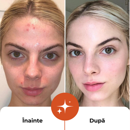 Ser Facial 5 in 1 Profesional