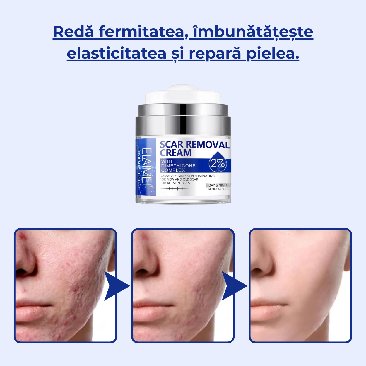 Crema pentru Cicatrici si Regenerare