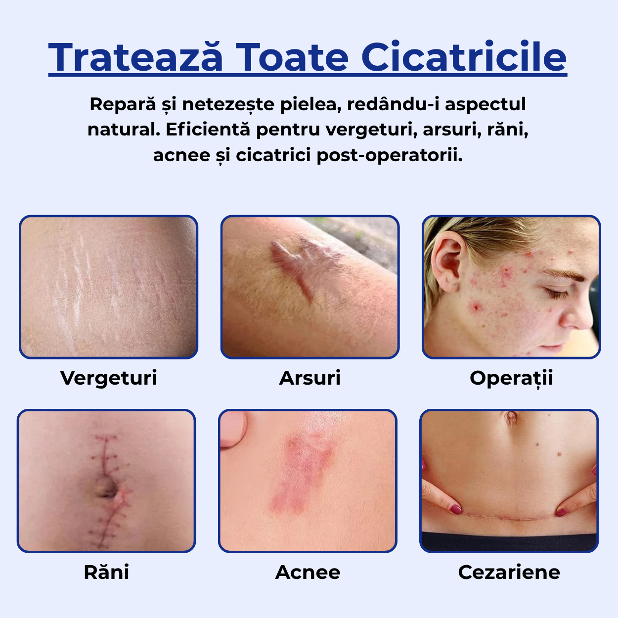 Crema pentru Cicatrici si Regenerare