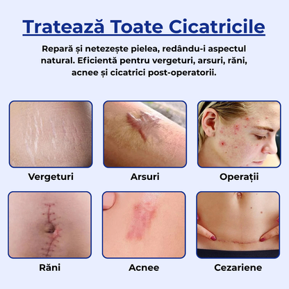 Crema pentru Cicatrici si Regenerare