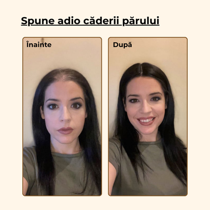 Ser cu Biotina pentru Cresterea Parului